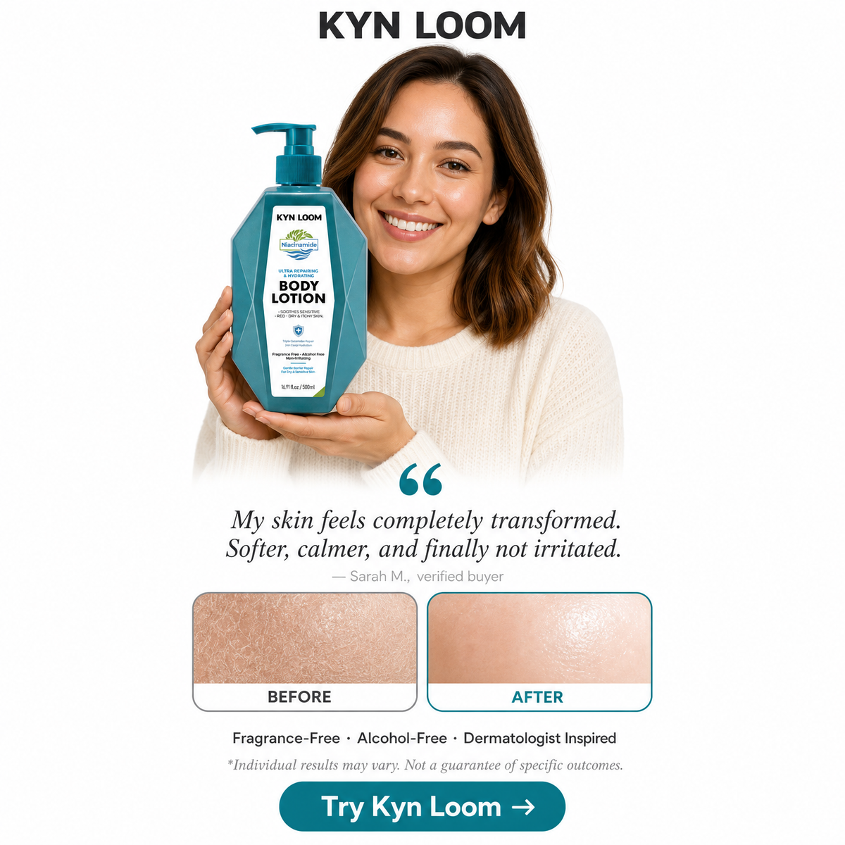 Woman holding a Kyn Loom body lotion bottle with before and after skin comparison on a white background.