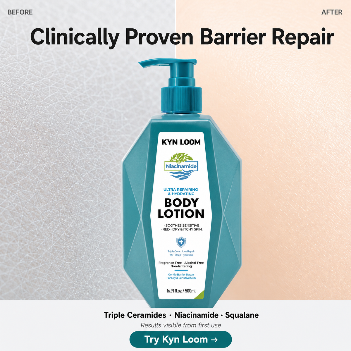 KYN LOOM body lotion bottle with 'Before' and 'After' text on a gradient background